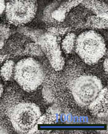 Free sex therapy hepatitis B virus under electron microscope